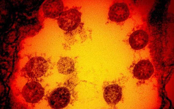 Second Covid-19 trial paused within 24 hours over safety concerns